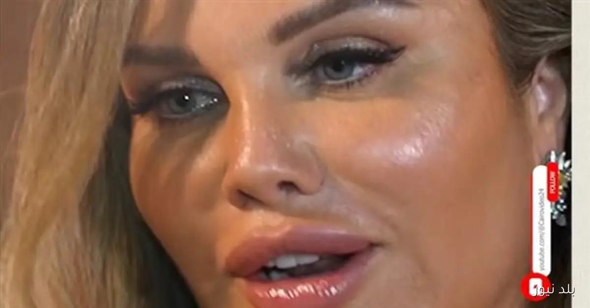 نيكول سابا تكشف عن أسباب لجوئها للوسائل التجميلية وسر جمالها يعود لجيناتها