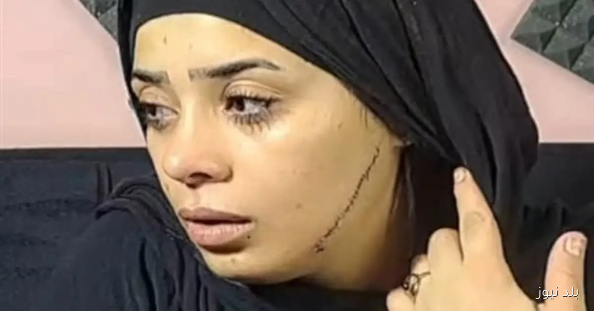 أولى جلسات محاكمة المتهمة بتشويه وجه عروس مصر القديمة 15 نوفمبر ب41 غرزة بالوجه